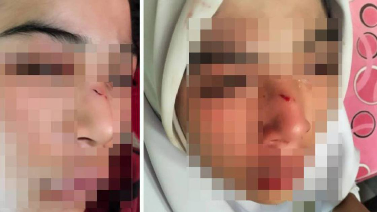 Kelantan Education Department Launches Investigation Into Alleged Assault of 15-Year-Old Student
