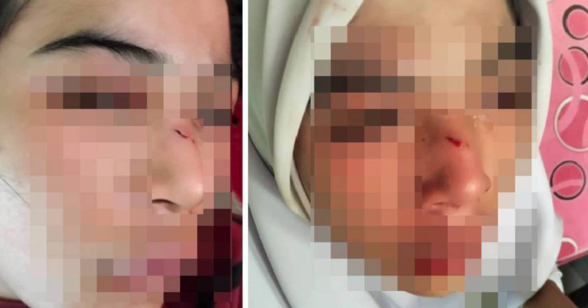 Kelantan Education Department Launches Investigation Into Alleged Assault of 15-Year-Old Student