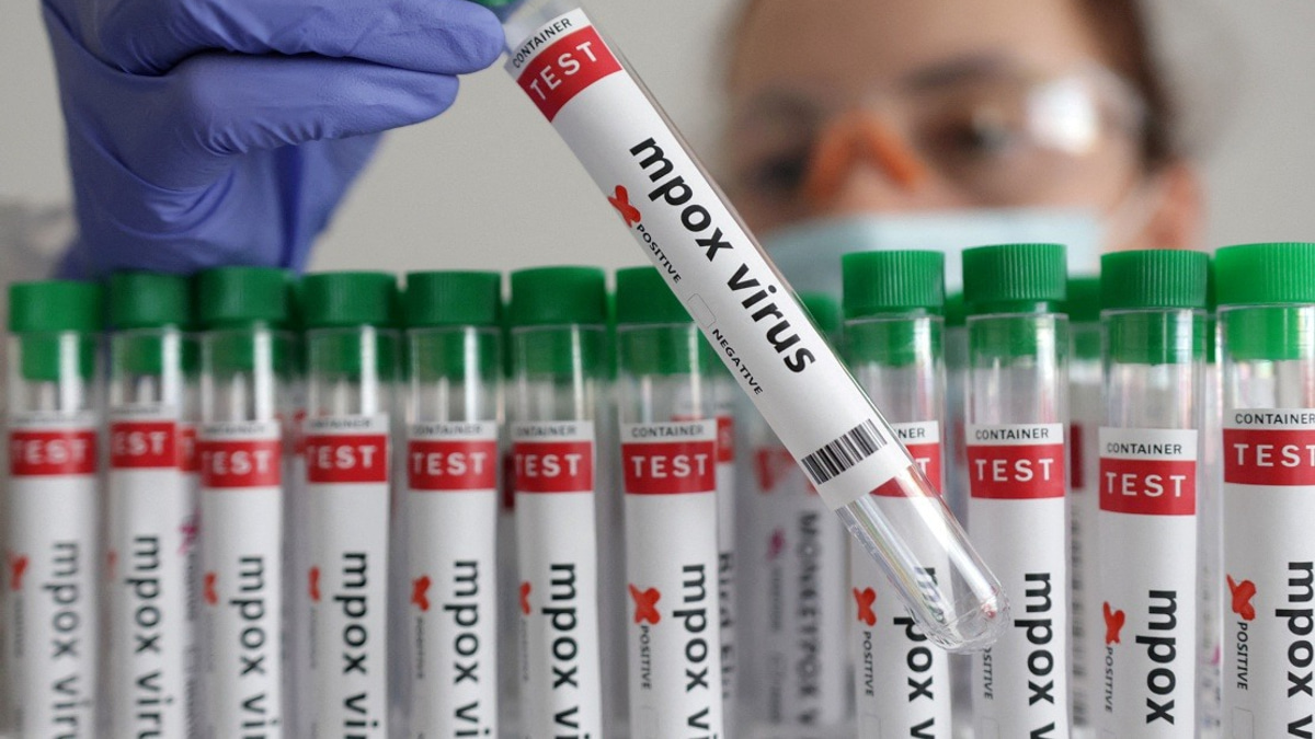Guinea-Bissau Reports First Mpox Case as Health Authorities Launch Response