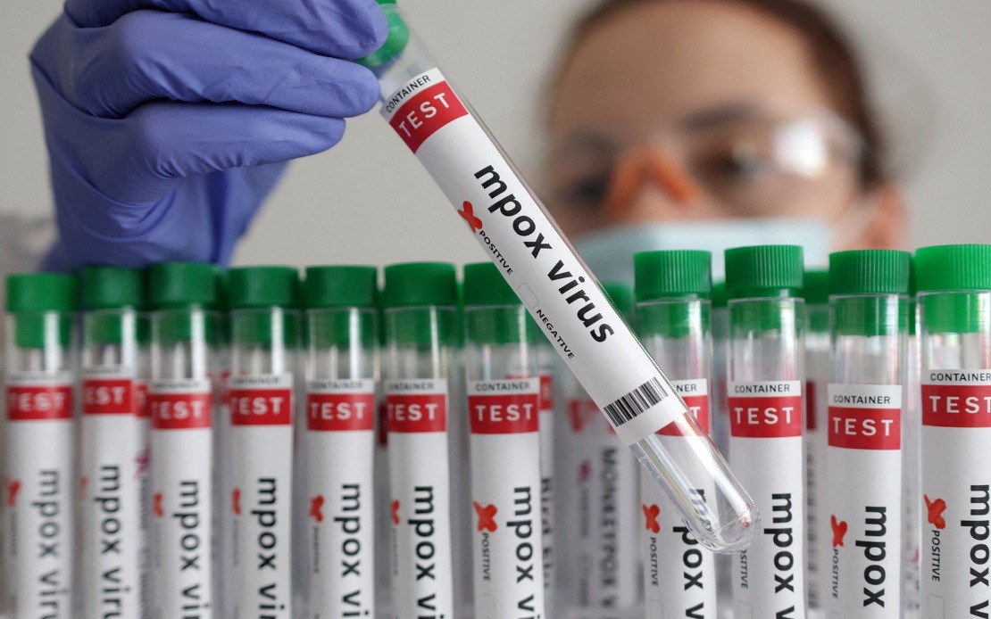 Guinea-Bissau Reports First Mpox Case as Health Authorities Launch Response