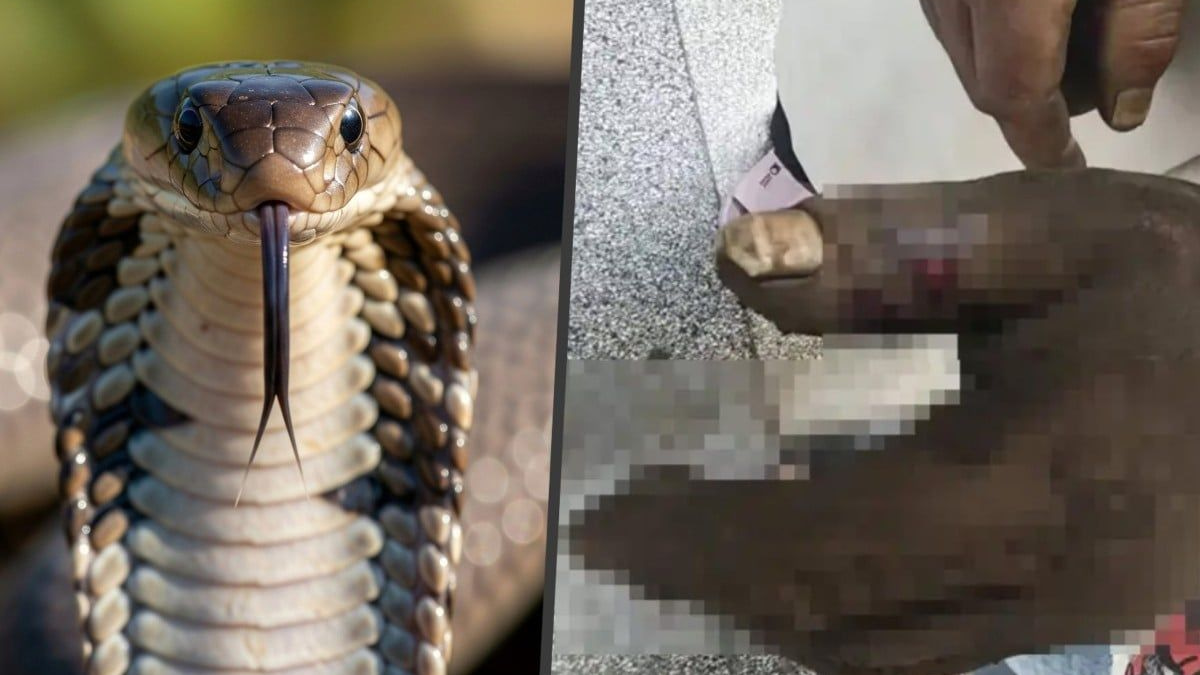 Chinese Woman Poisoned After Sucking Cobra Venom from Husband's Bite