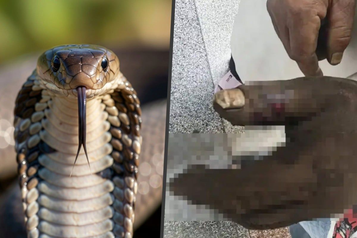 Chinese Woman Poisoned After Sucking Cobra Venom from Husband's Bite