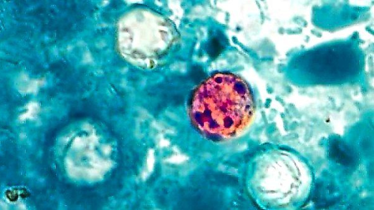 Why Cyclospora Remains One of Food Safety's Most Elusive Threats