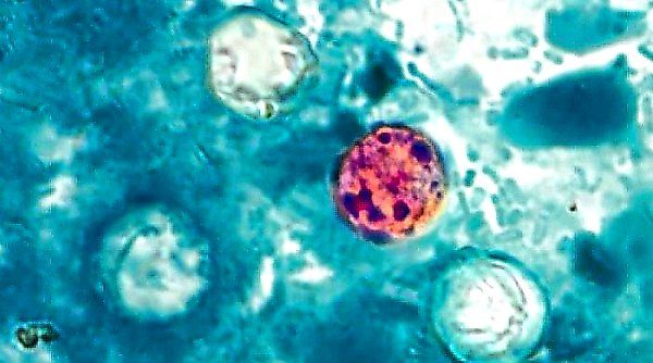 Why Cyclospora Remains One of Food Safety's Most Elusive Threats