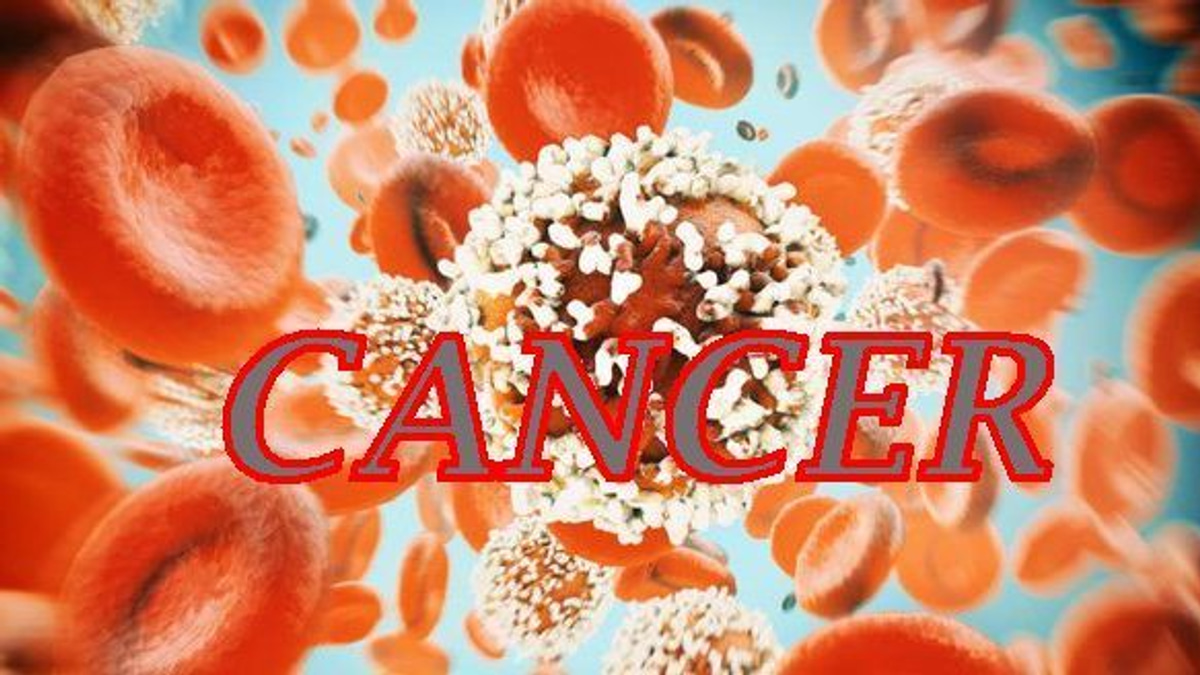 The Hidden Crisis: Why Young People Are Getting Colorectal Cancer Earlier Than Ever