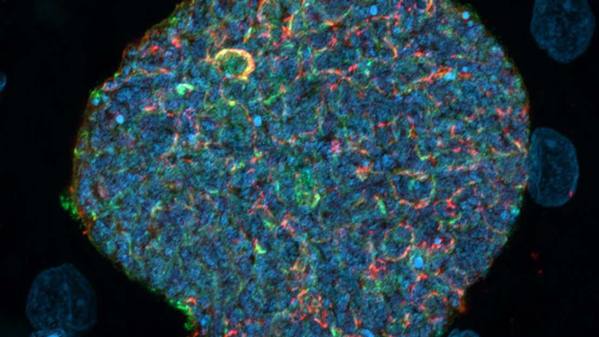 Australian Scientists Develop Novel Malaria Vaccine Using Mosquito Bites as Natural Immune Boosters