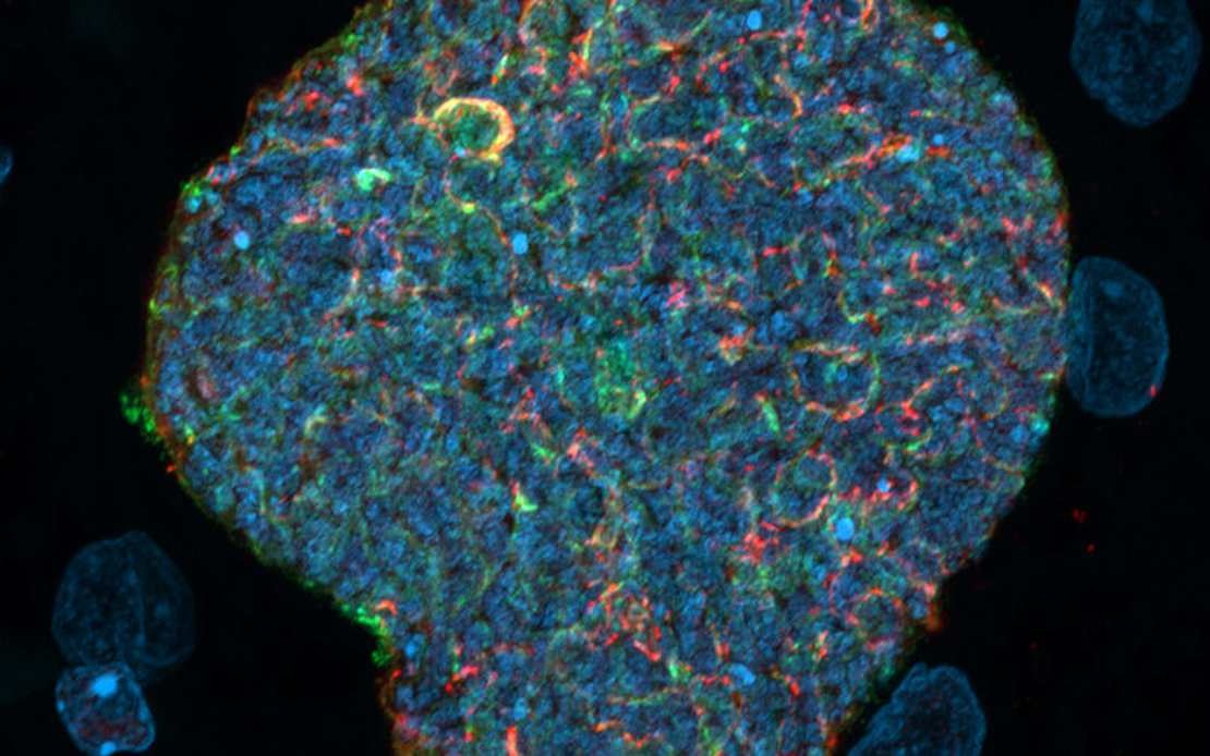 Australian Scientists Develop Novel Malaria Vaccine Using Mosquito Bites as Natural Immune Boosters
