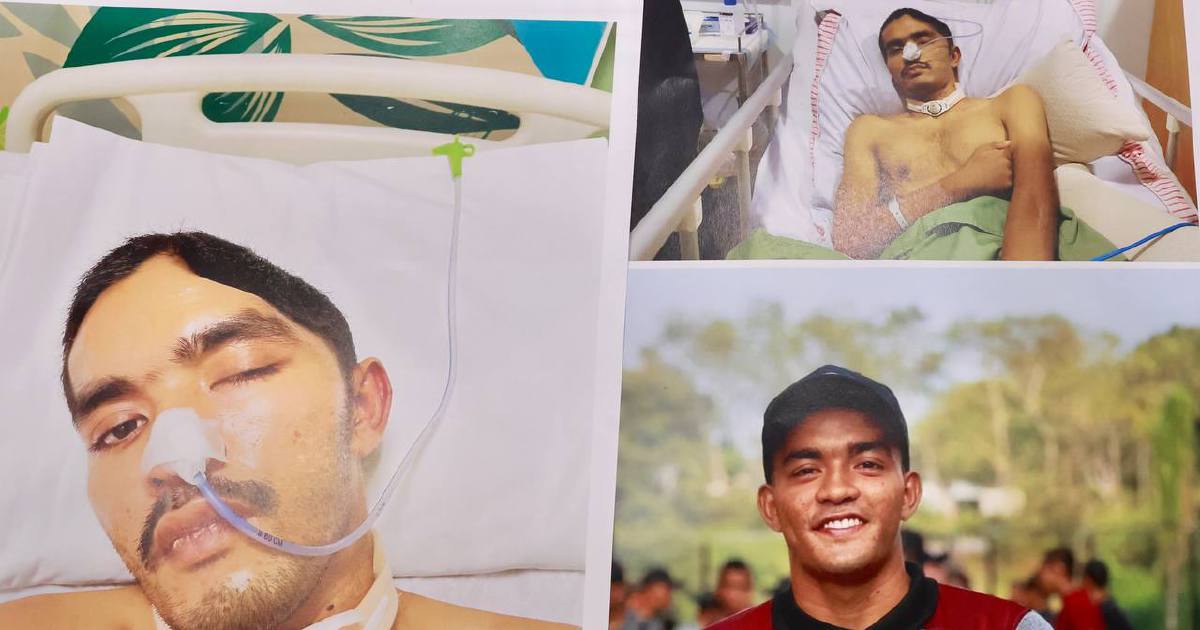 Army Concludes Investigation into Johor Camp Commando Injury; Dismissals Proceed