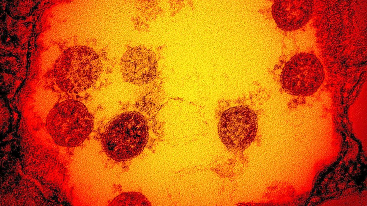 Cambridge Scientists Develop 'Universal' Vaccine Technology Using AI to Combat Multiple Viruses
