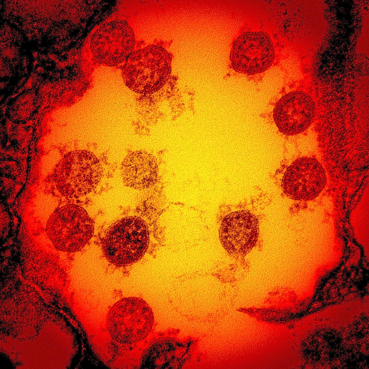 Cambridge Scientists Develop 'Universal' Vaccine Technology Using AI to Combat Multiple Viruses